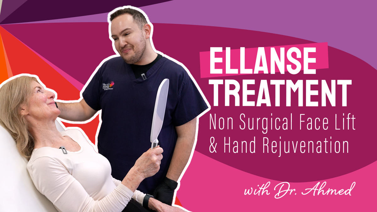 Ellanse Treatment Video Thumnail Design by Dimention Digital